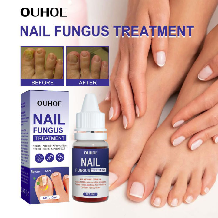 Share more than 139 medicated nail polish latest
