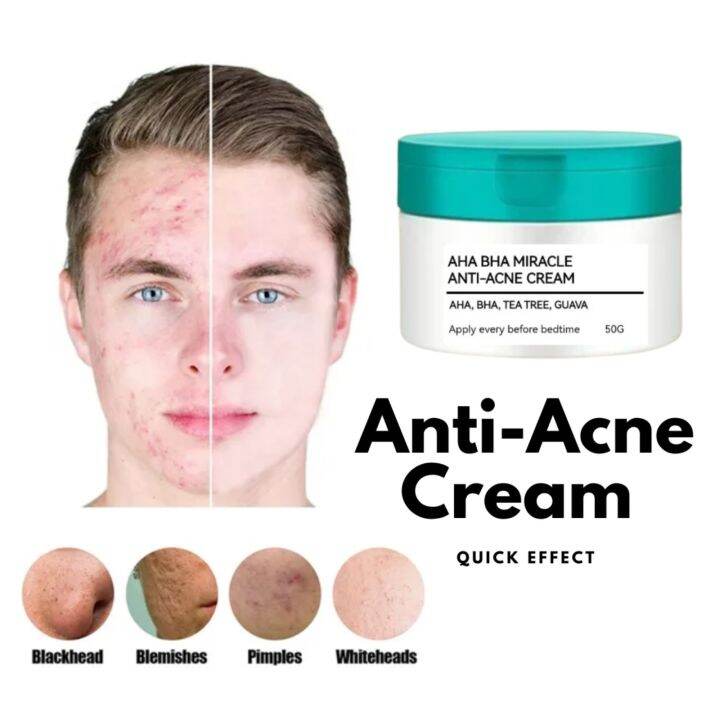 50GRAMS AHA BHA MIRACLE ANTI ACNE CREAM QUICK EFFECT/ Removes Pimples
