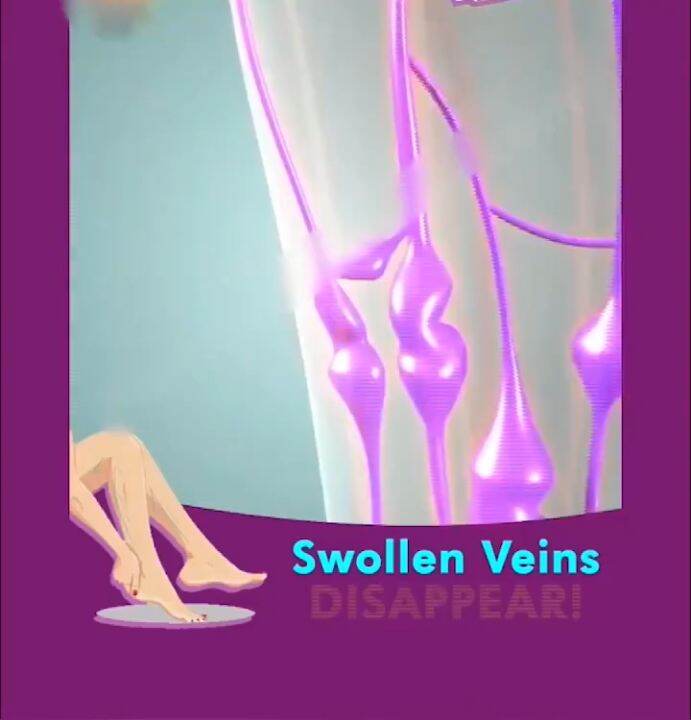 100 original varicose vein repair cream 50g promotes blood circulation