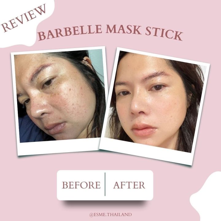 มาร์คแท่งบาเบล-สูตรออแกนิกเจ้าแรกในไทย-barbelle-mask-stick