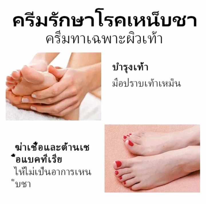 sumifun-ครีมทาลดกลิ่นเท้า-ยาแก้ปวด-ครีมระงับกลิ่นเท้า