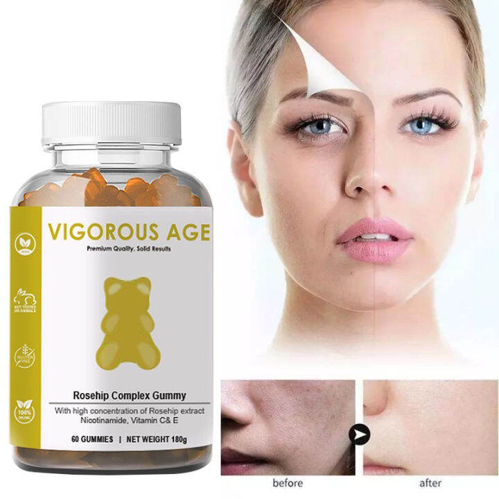 Oral Niacinamide Collagen Gummies Skin Whitening AntiAging Beauty
