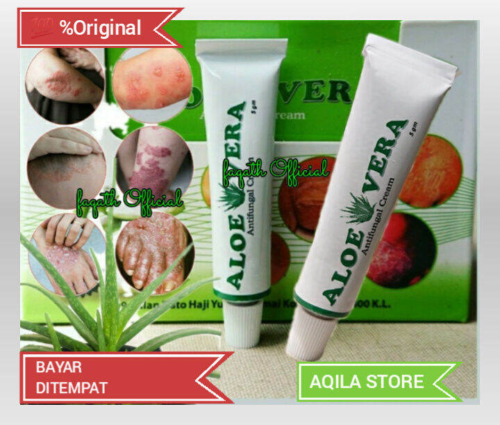 ALOEVERA ANTIFUNGAL KRIM OBAT GATAL IRITASI KULIT RUAM KERINGAT