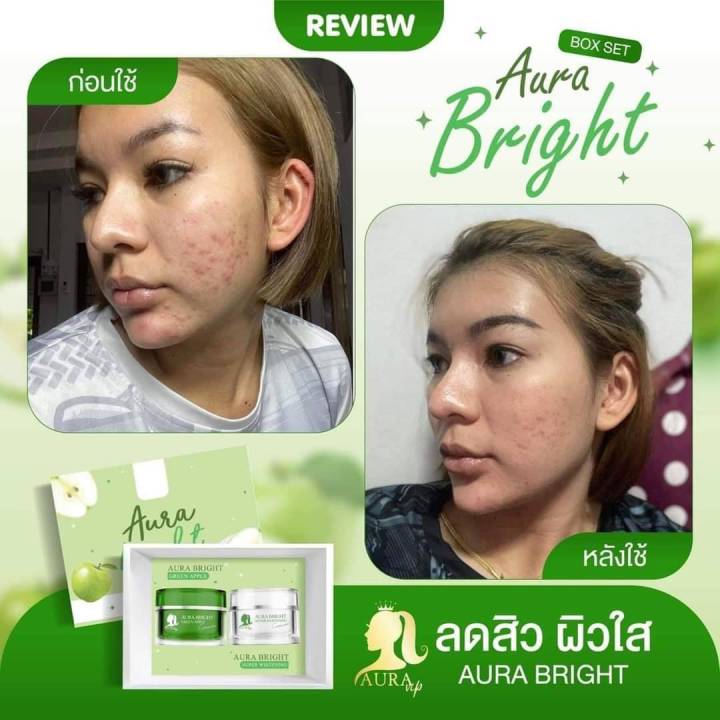 aura-bright-by-aura-vip-ครีมหน้าใส-แอปเปิ้ลเขียว-ออร่าไบร์ท