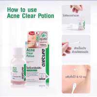 OxeCure Acne Clear Potion 15ml สูตรลับไร้สิวด้วยแป้งน้ำชมพูแต้มสิว 1 ขวด