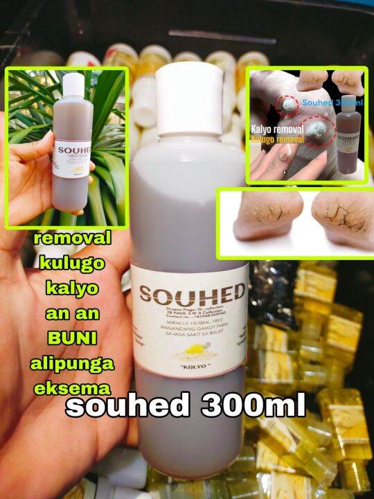 SOUHED 300ML | KULUGO REMOVAL KALYO REMOVAL | Lazada PH