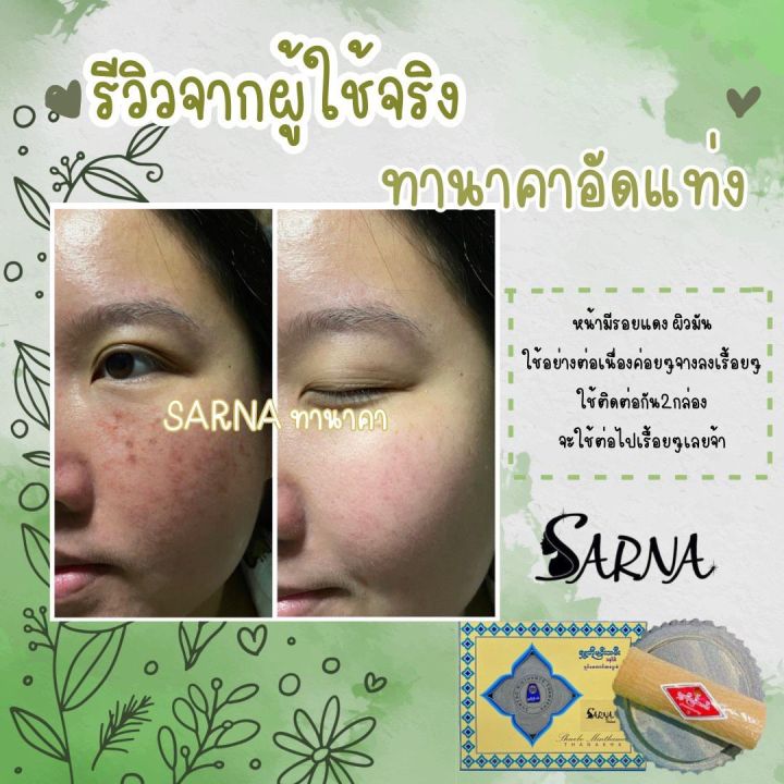 ส่งฟรี-แถมฟรีแปรงมาร์ก-ทานาคา-ทานาคาพร้อมหินฝน-ทานาคาแท้นำเข้าจากพม่า