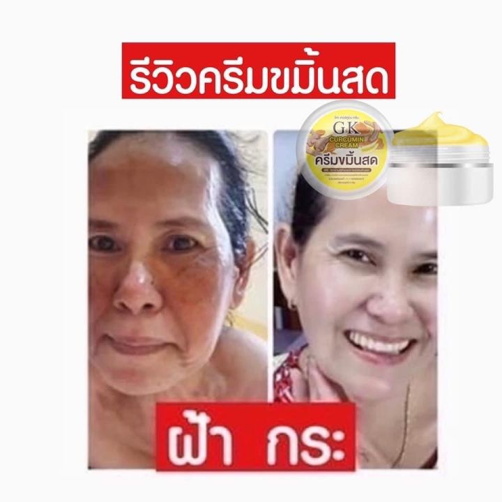 ครีมขมิ้นสด-gk-ลดฝ้า-5แถม5-390-บาท-ส่งฟรี