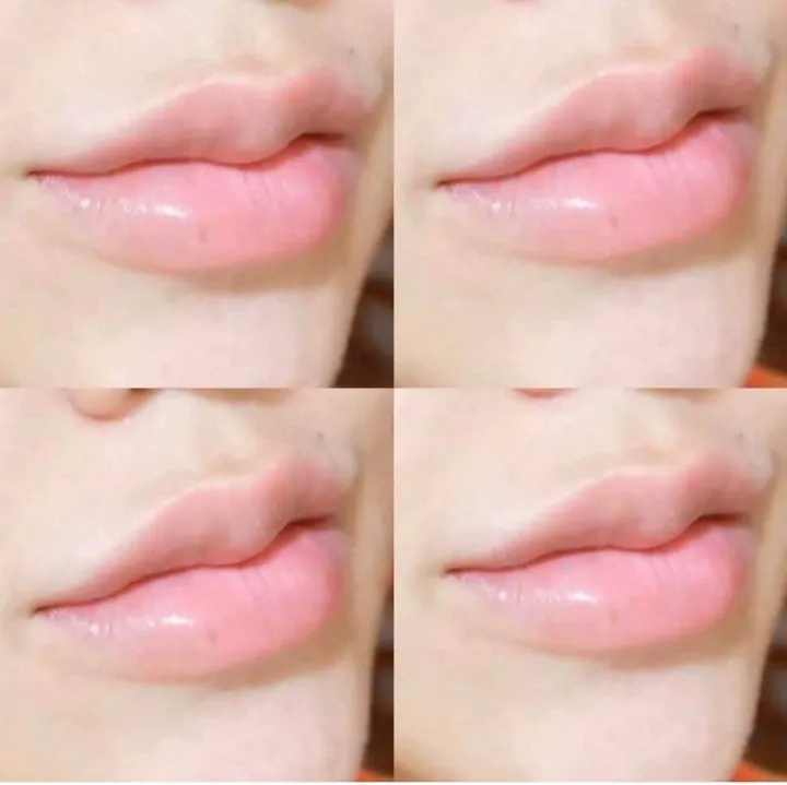 ลิปเภสัชกร-ลิปแก้ปากดำ-ultra-lip-treatment-ลิปมันเภสัชในตำนานแก้ปากดำคล้ำให้ริมฝีปากชมพูขึ้นกลิ่นแครนเบอร์รี่หอมทาแล้วดูปากสุขภาพดี