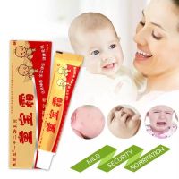 ครีมสำหรับเด็ก กลากน้ำนม ผดร้อน เกลื้อนน้ำนม น้ำลาย ผื่นผ้าอ้อม Baby Eczema Cream