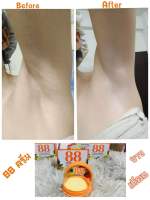 ครีมรักแร้ขาว 88 Total White Underarm Cream 35g. ครีมปรับสภาพผิวรักแร้ขาว 35กรัม