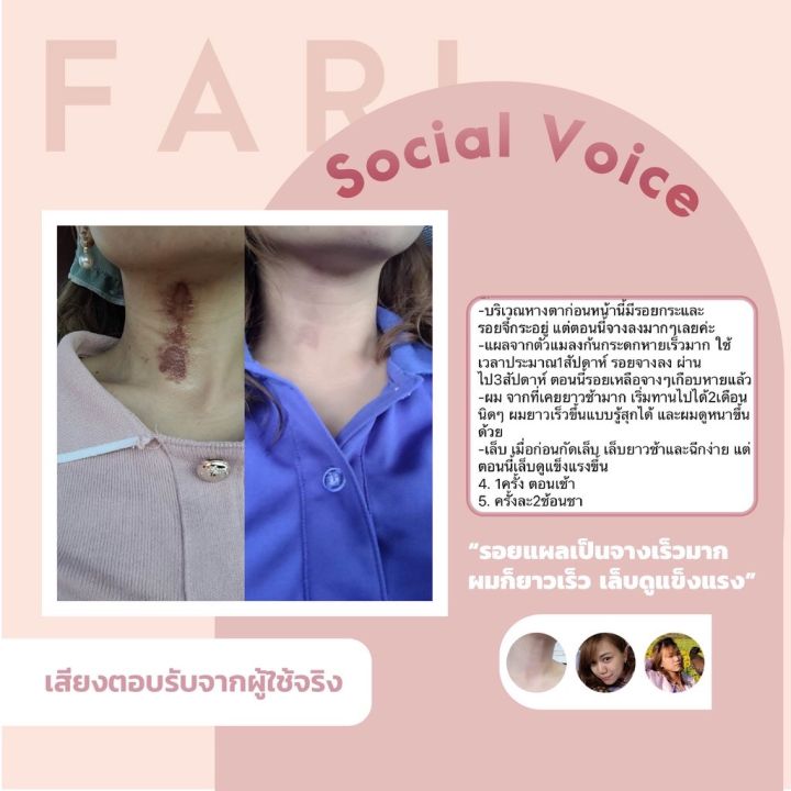 ฟาริคอลลาเจน-fari-collagen-ผลิตภัณฑ์เสริมอาหารเพื่อสุขภาพ