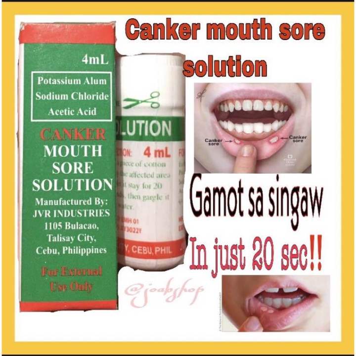 canker-mouth-sore-solution-singaw-treatment-lazada-ph