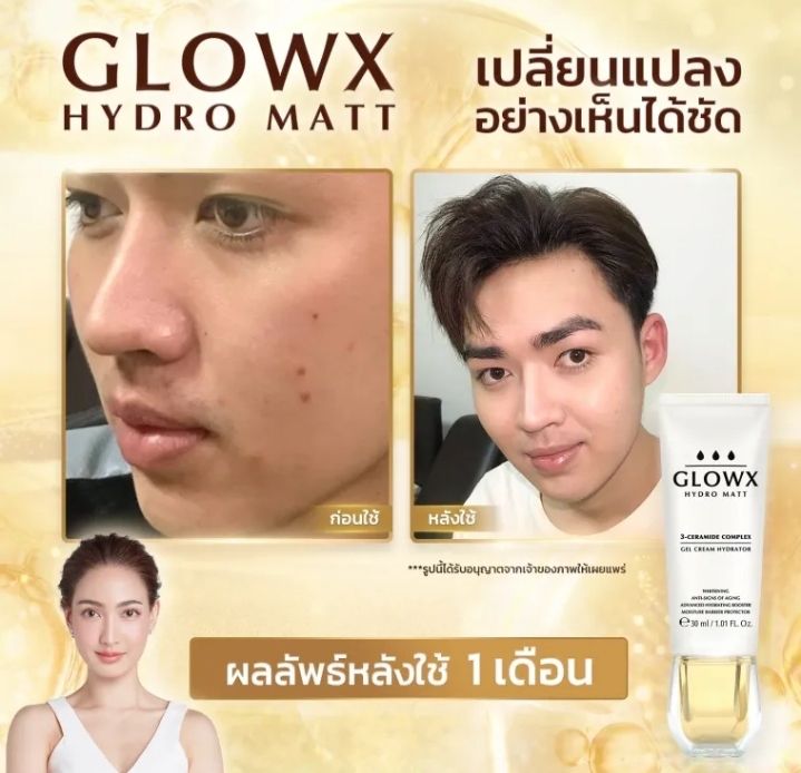 พร้อมส่งglowx-โกรว์เอ็กซ์เจลครีม-บำรุงผิวหน้าชุ่ทชื่น-สว่างใส-ลดฝ้า-กระ-จุดด่างดำ