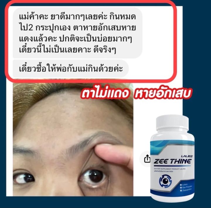 zee-thine-ซีทีนวิตามิน-ซีทีน-อาหารเสริมบำรุงดวงตา-วิตามินบำรุงดวงตา