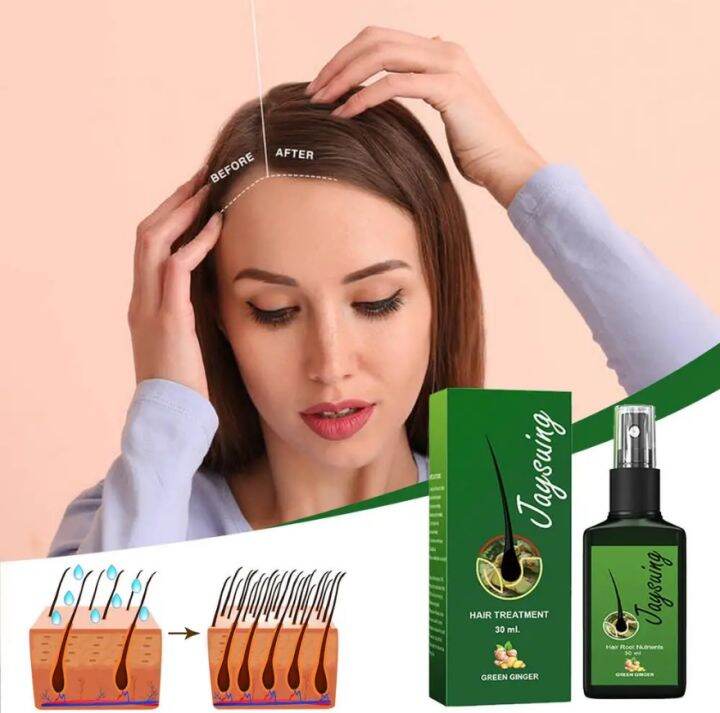 120ml Ginger Hair Growth Spray AntiHair Loss Baldness Strengthens Hair