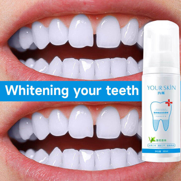 YOUR SKIN Teeth Whitening Mousse Toothpaste Dental Oral Hygiene Remove