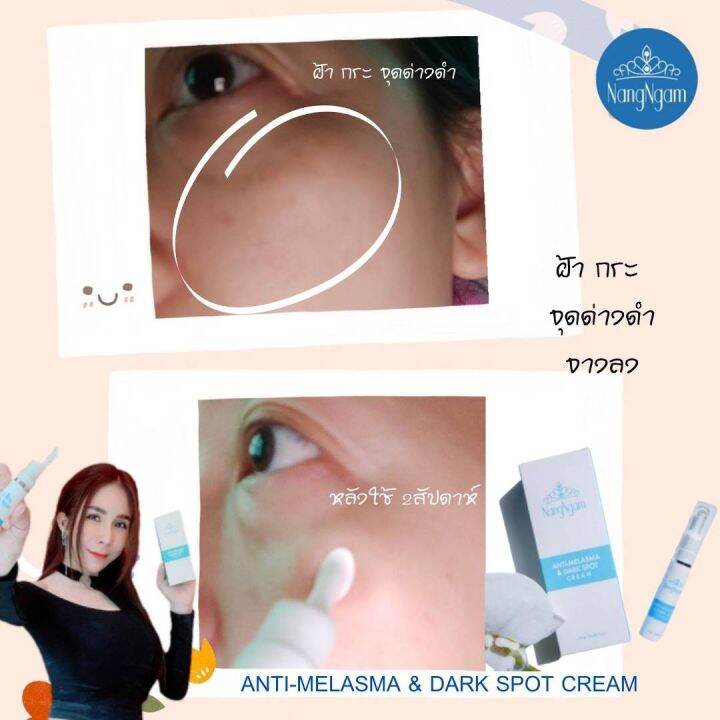 เซรั่มฝ้า-นางงาม-ทาฝ้า-กระ-จุดด่างดำ-anti-melasma-amp-dark-spot-cream-3-หลอด