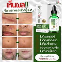 Bioscarไบโอสการ์ ลดแผลเป็น

ตุ่ม รอยสิว แผลเป็น น้ำเหลืองไม่ดี ผิวแพ้ง่ายใช้ได้ !!


ปรับผิวขาว เรียบเนียน ลบรอย

เข่าดำ ศอกดำ คอดำ ต้องใช้

เซรั่มเข้มข้น เห็นผลไว