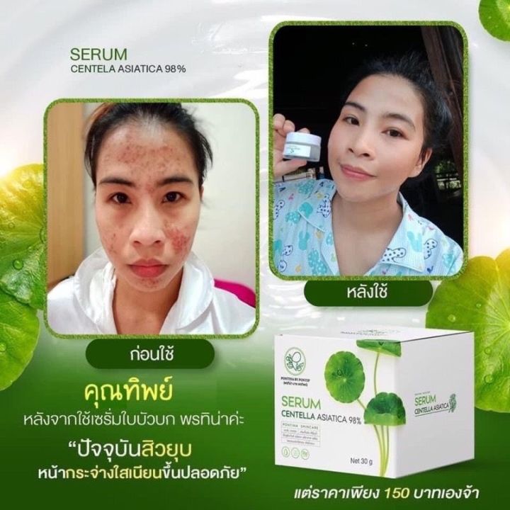 เซรั่มใบบัวบก-amp-สบู่ใบบัวบก