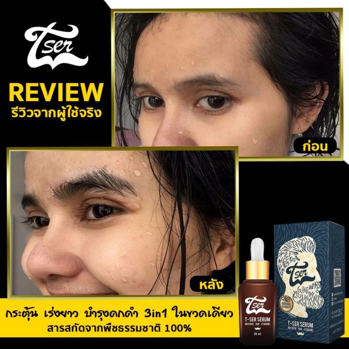 ลดกระหน่ำ-8-8-วันเดียว-t-ser-ทีเซอร์เซรั่มปลูกผม-ปลูกคิ้ว-ปลูกหนวด-25ml-1ขวด-tser-เซรั่มปลูกผม-ปลูกคิ้ว-ปลูกหนวด