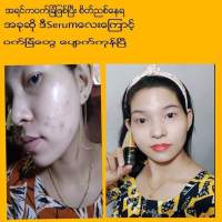 မ်က္ႏွာေလး အသား‌ေရာင္မညီတာေတြ 

အဖုေတြမရွိဘဲ လွေနတယ္မို့လား

မွန္ၾကည့္တိုင္းစိတ္ခ်မ္းသာလို့ ေက်းဇူးပါ GDB ?? 

GDB serum နဲ႔ ေနတိုင္း skincare ပါ

မ်က္ႏွာေလးကိုေရဓာတ္ျဖည့္ေပးတယ္ 

ဝက္ၿခံကင္းၿပီး ၾကည္လင္ glow ေစတယ္

အေရေၾကာင္းကင္းၿပီး အရြယ္တင္တယ္