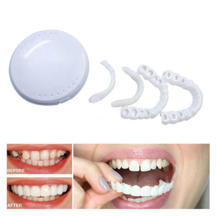 False Teeth Smile Veneers Silicone Whitening Fake Tooth Smile Veneer