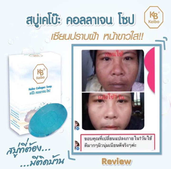 สบู่ลดฝ้า-กระ-จุดด่างดำ-ลดสิว-2-ก้อน-118-บาท-ขนาด-60-กรัม-พร้อมส่ง