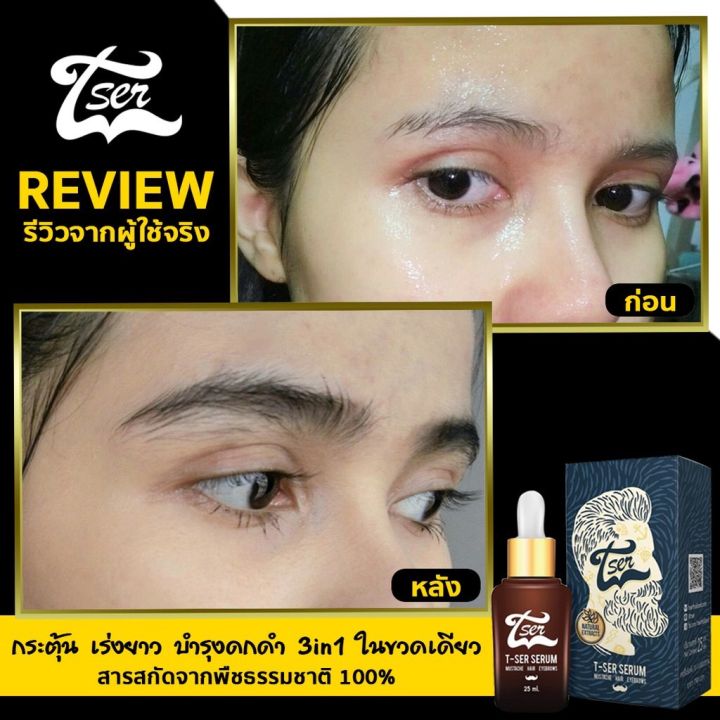 ลดกระหน่ำ-8-8-วันเดียว-t-ser-ทีเซอร์เซรั่มปลูกผม-ปลูกคิ้ว-ปลูกหนวด-25ml-1ขวด-tser-เซรั่มปลูกผม-ปลูกคิ้ว-ปลูกหนวด