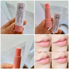 ลิปแก้ปากดำ Ultra Lip Treatment ลิปมันเภสัชในตำนานแก้ปากดำคล้ำให้ริมฝีปากชมพูขึ้นกลิ่นแครนเบอร์รี่หอมทาแล้วดูปากสุขภาพดี  | Lazada.Co.Th