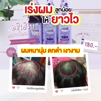 🔥แชมพู อชิเฮิร์บ  Achi Herb shampoo ดูแลหนังศรีษะ เร่งผมยาว ผมดกดำ หนานุ่ม X3 ใช้ได้ทั้งเด็กและผู้ใหญ่