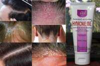 HAICNEAL  EXTERNAL  USE