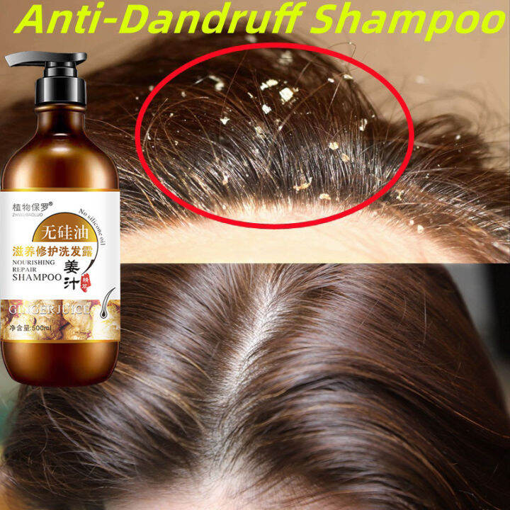 Shampoo Anti Kelemumur Dan Rambut Gugur oil control Anti Dandruff Hair