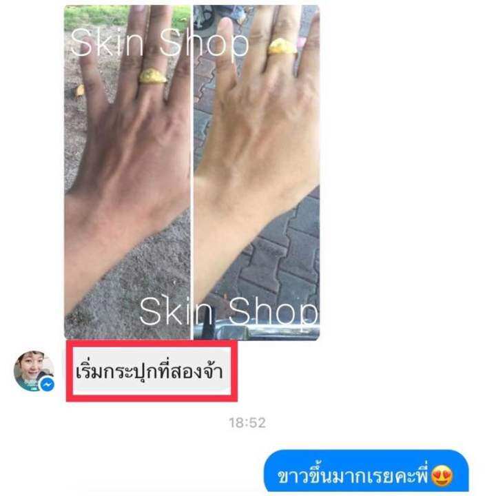 หัวเชื้อเวียดนาม-สูตรเวียดนามเร่งขาว-10-ของแท้