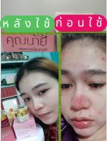 ครีมหน้าขาวใสไร้สิวฝ้า #ครีมคุณนายเซ็ต3ชิ้น