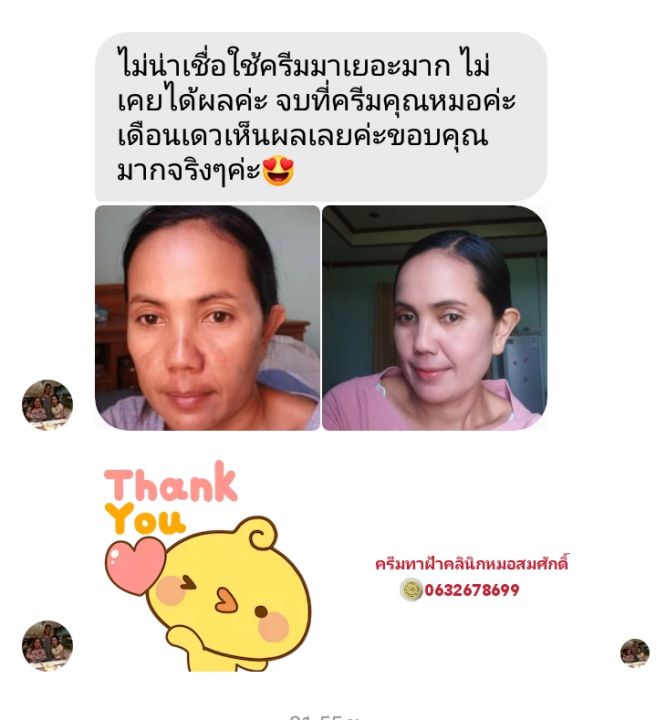 ส่งฟรี-คู่ครีมรักษาฝ้า-หน้าเงาใส-คลินิกหมอสมศักดิ์-นายแพทย์สมศักดิ์-คุณจักร