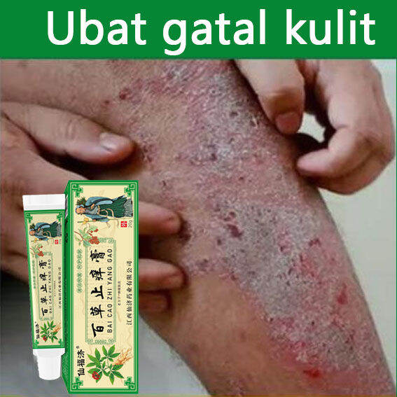 Eczema Psoriasis Cream antibacterial Itching cream Inner thigh itching ...