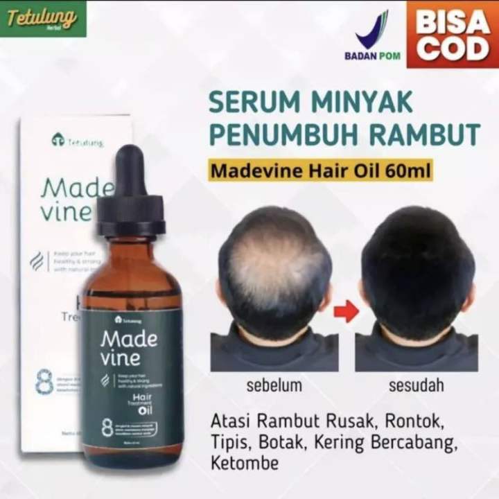 Madevine Hair Oil Rambut Rontok Dan Penumbuh Rambut Pria Dan Wanita