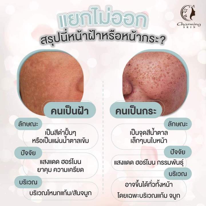 charming-night-cream-ผิวใสได้ไม่พึ่งหมอ-หนักแค่ไหนก็หายได้-ทุกปัญหาผิวหน้า-สิว-ฝ้า-กระ-รอยดำ-รอยแดง-รูขุมขนกว้าง-หลุมสิว-ผิวแห้ง-อาหารผิวสูตรเข้มข้น-มีเลขที่จดแจ้ง-ปลอดภัย-ใช้ง่าย-ใช้ได้แม้-ผิวแพ้ง่าย