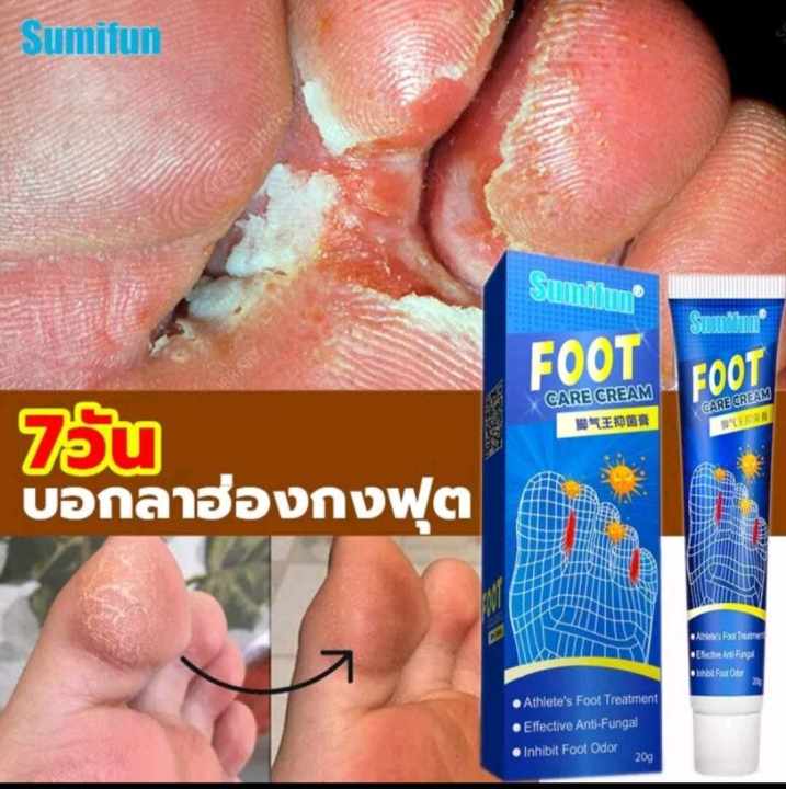 sumifun-ครีมทาลดกลิ่นเท้า-ยาแก้ปวด-ครีมระงับกลิ่นเท้า