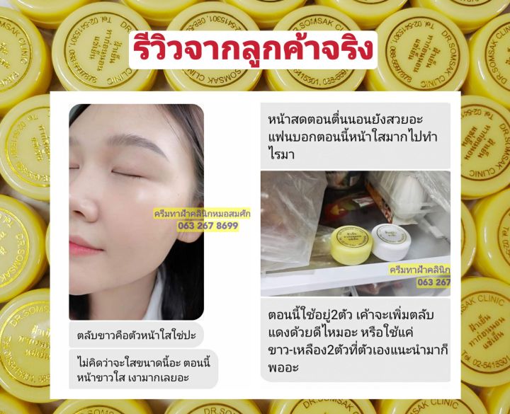 ส่งฟรี-คู่ครีมรักษาฝ้า-หน้าเงาใส-คลินิกหมอสมศักดิ์-นายแพทย์สมศักดิ์-คุณจักร