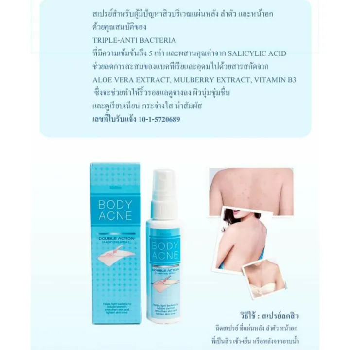 สเปรย์ฉีดสิว-มิสทีน-สิวบริเวณแผ่นหลัง-หน้าอก-หรือลำตัวหายเกลี้ยง-รอยสิวจางลง-แผ่นหลังเรียบเนียนขึ้น-ใส่ชุดไหนก็มั่นใจ