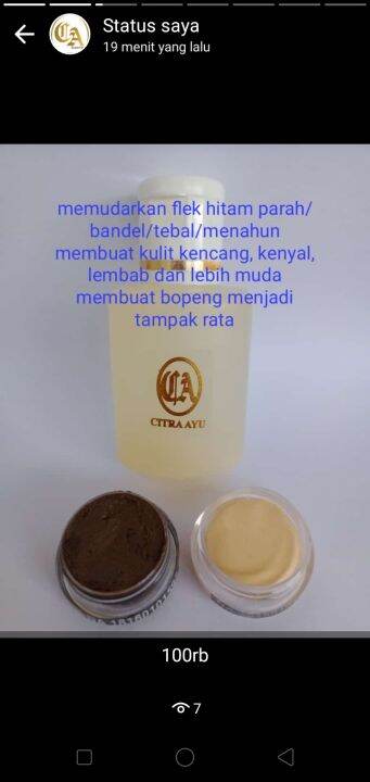 Skincare Untuk Memudarkan Flek Hitam