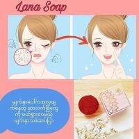 ဝက်ခြံ ပျောက်တ့ဲ မျက်နှာသစ် Lana soap ဆပ်ပြာ