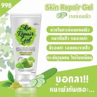 เจลใบบัวบก ลดสิว เจลซ่อมผิว เอริกะ Erika​  Skin Repair Gal เจลซ่อมผิว ลดสิว หน้าใส  รักษาสิว ลดรอยดำรอยแดง หลุมสิว