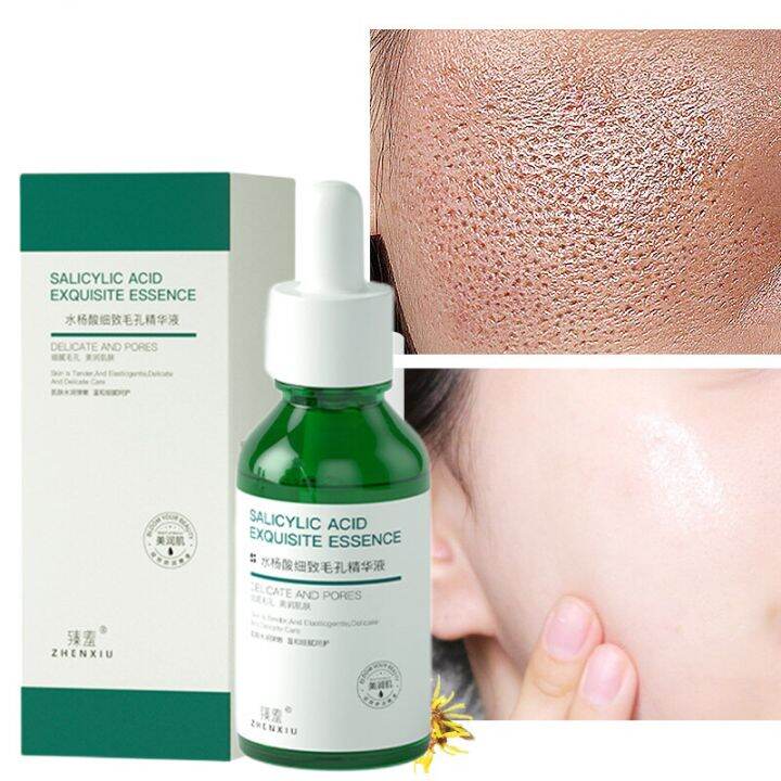 salicylic acid serum pore refining serum Salicylic Acid Pore Shrinking