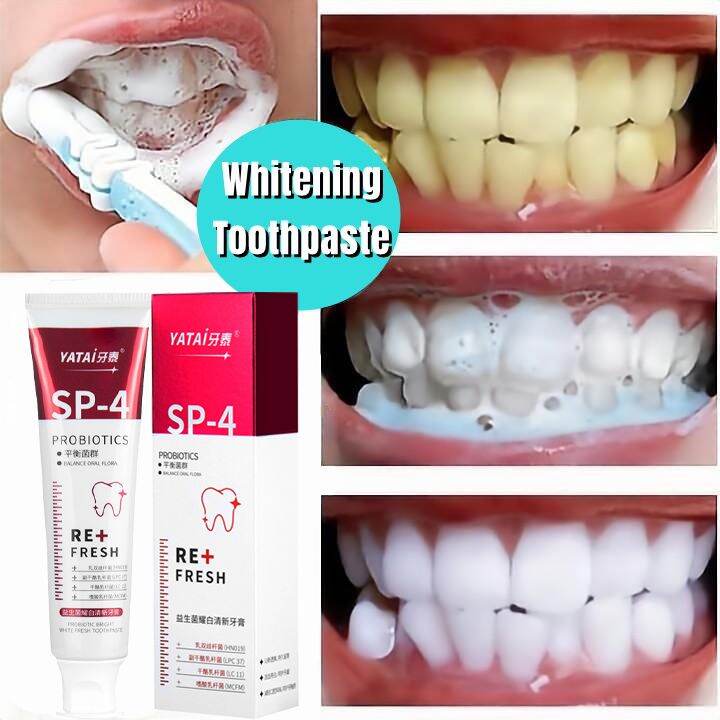 original yatai toothpaste teeth whitening pemutih gigi sp4 probiotic ...