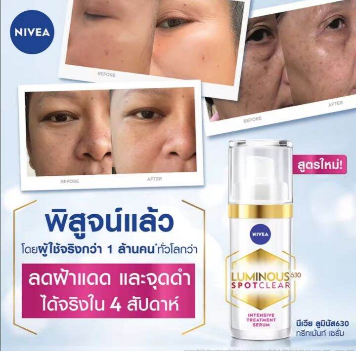 nivea-luminous-630-spotclear-intensive-treatment-serum-30ml-นีเวีย-ลูมินัส630-สปอตเคลียร์-อินเทนซีฟ-nbsp-ทรีทเม้นท์-nbsp-เซรั่ม-ทรีทเม้นท์ลดเลือนจุดด่างดำ-ฝ้าแดดสะสม-30มล