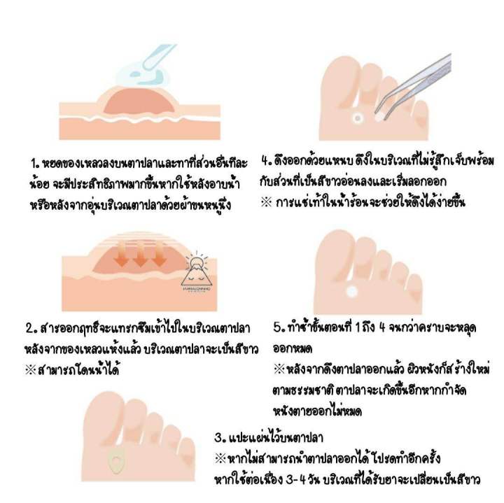 ibokorori-ivocori-6ml-ยาหยอดรักษาตาปลา-หูด-ยาสลายตาปลาหูด-ญี่ปุ่น