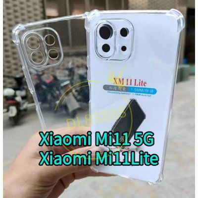 Mi11 ✨พร้อมส่งในไทย✨เคสใสกันกระแทกคลุมกล้อง For Xiaomi Mi11 5G  Xiaomi Mi11  XiaomiMi11 / Mi11Lite / Mi11 Lite / Mi 11 Lite 5G ne / Mi 11 Pro / Mi11Pro